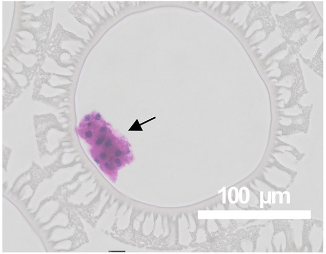 https://stratus.campaign-image.com/images/730199000027039004_zc_v1_1735003093097_intracapillary_of_hollow_fiber.jpg